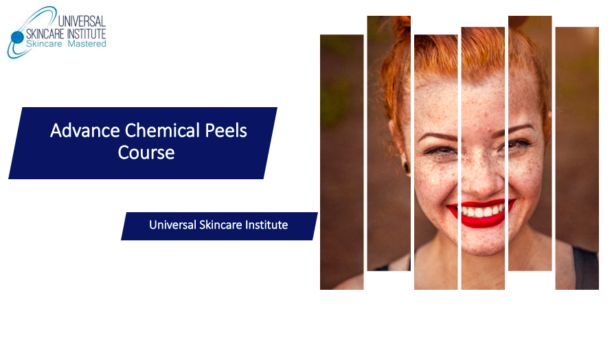 Read more about the article Advance Chemical Peels